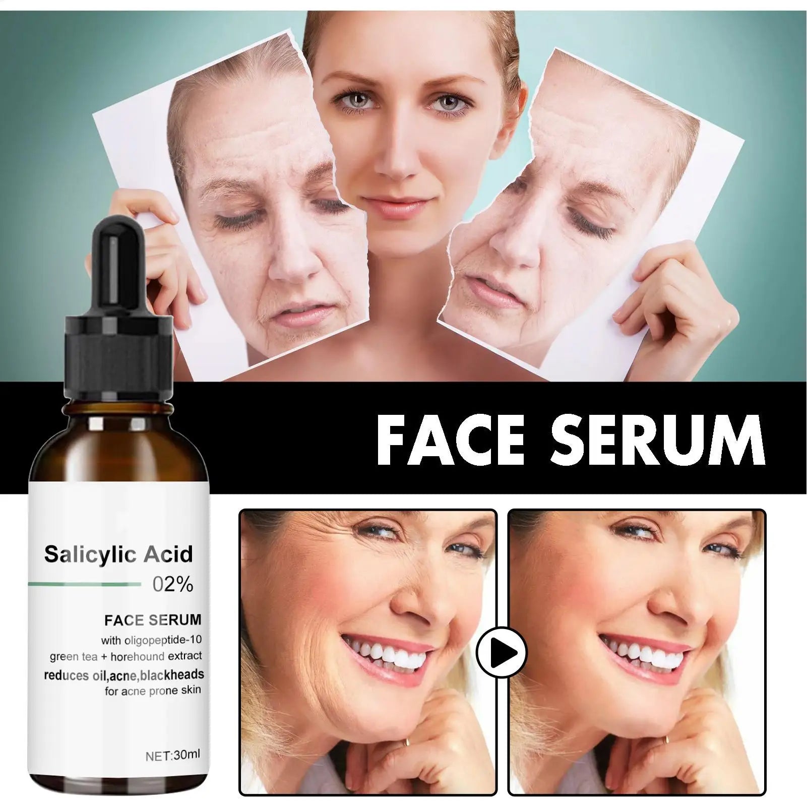 Salicylic Acid Pore Shrink Face Serum for Oil Control & Anti-Wrinkle