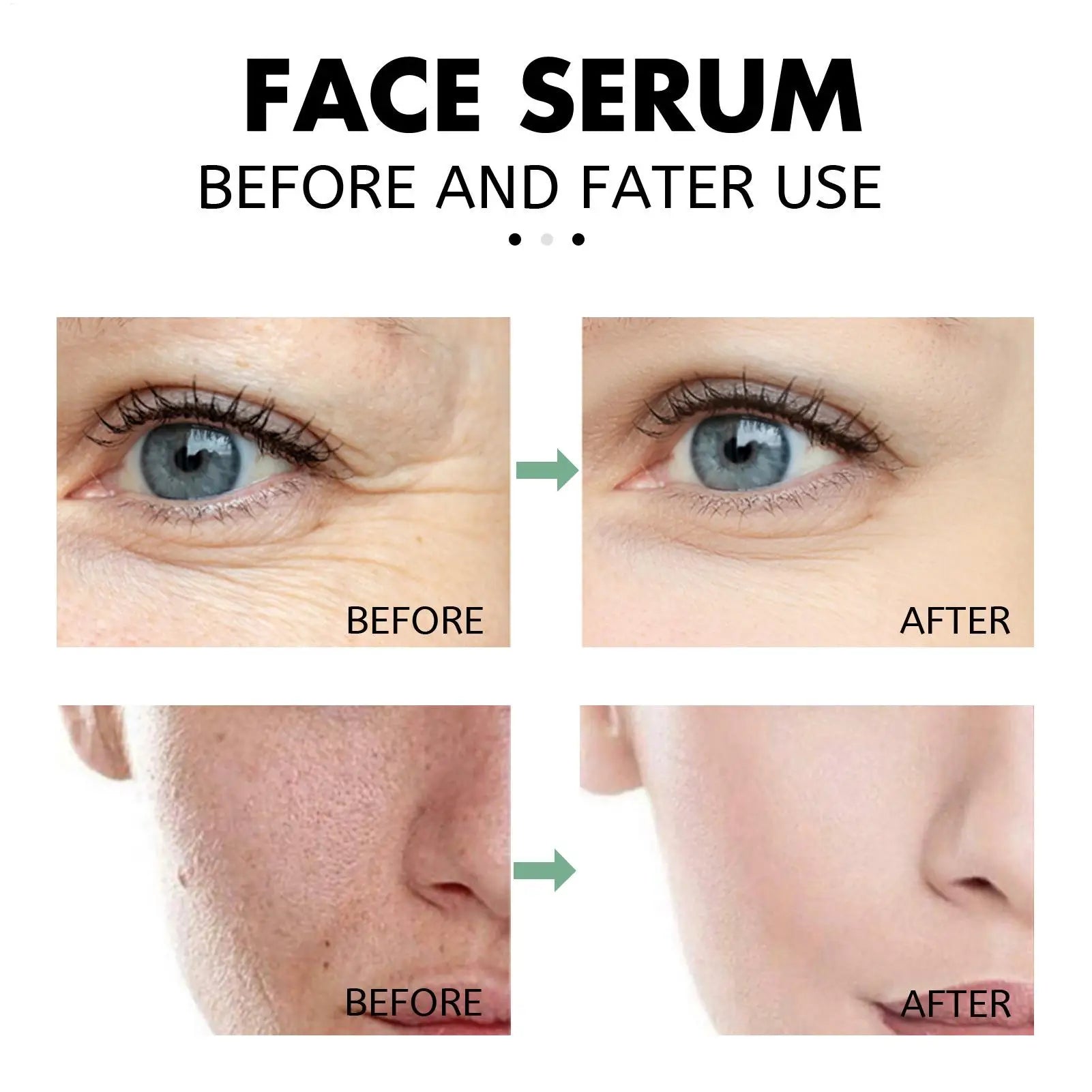 Salicylic Acid Pore Shrink Face Serum for Oil Control & Anti-Wrinkle