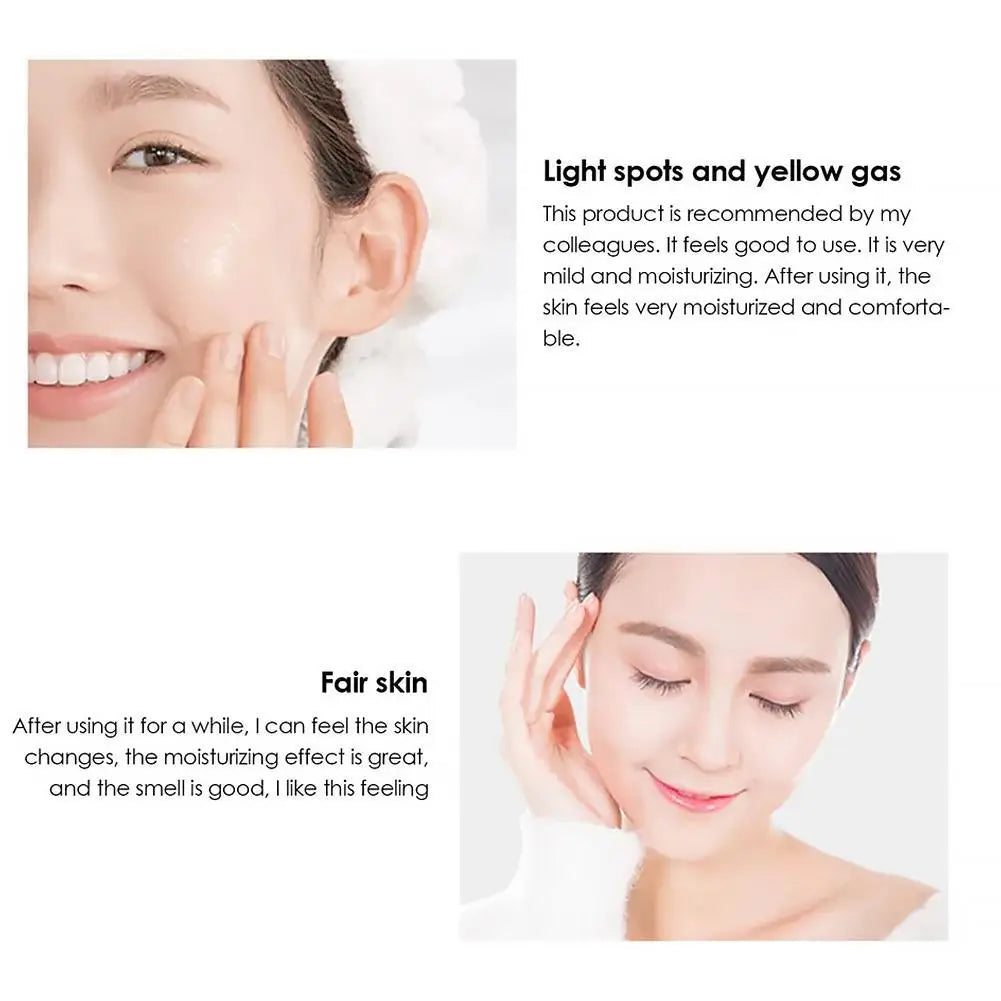 Whitening & Anti-Freckle Face Cream – Dark Spot & Melasma Corrector؜